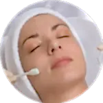 Химический пилинг